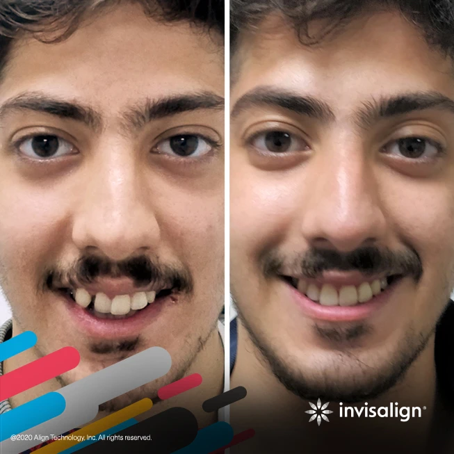 IN_4
